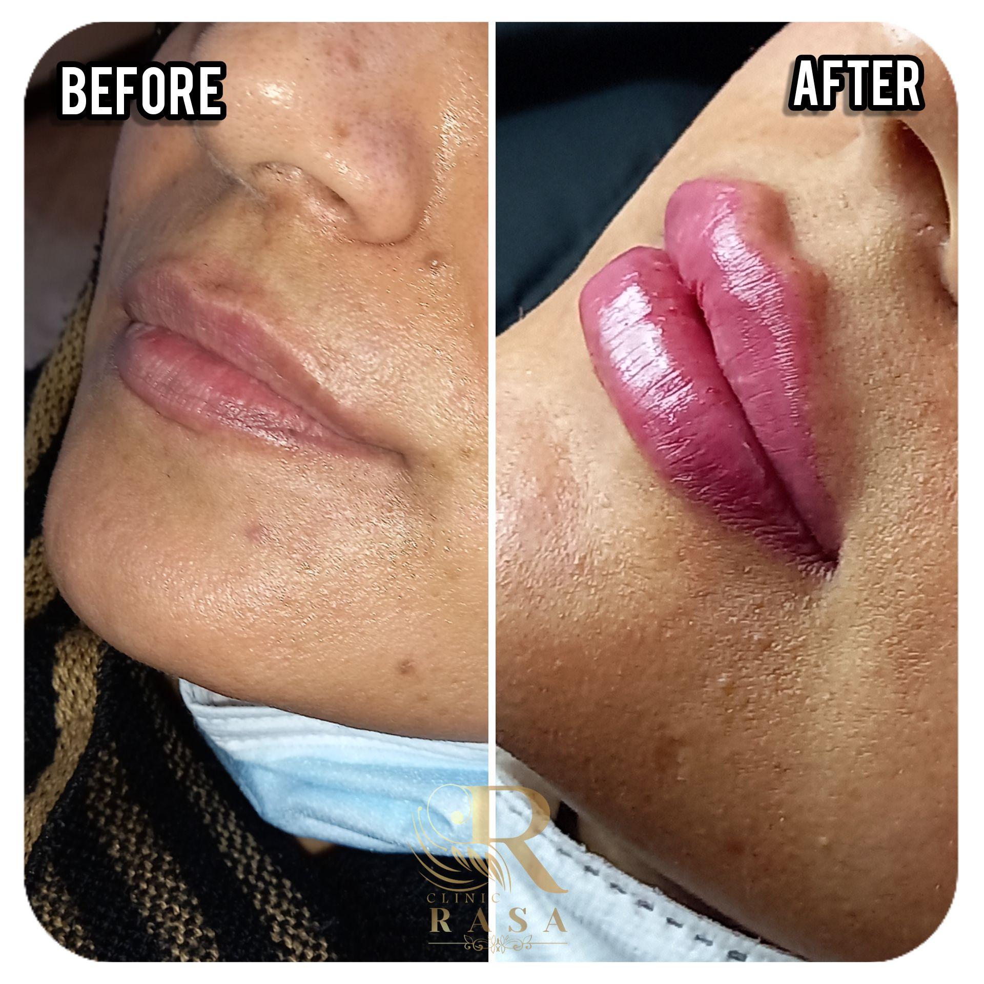 کلینیک زیبایی و پوست راسا