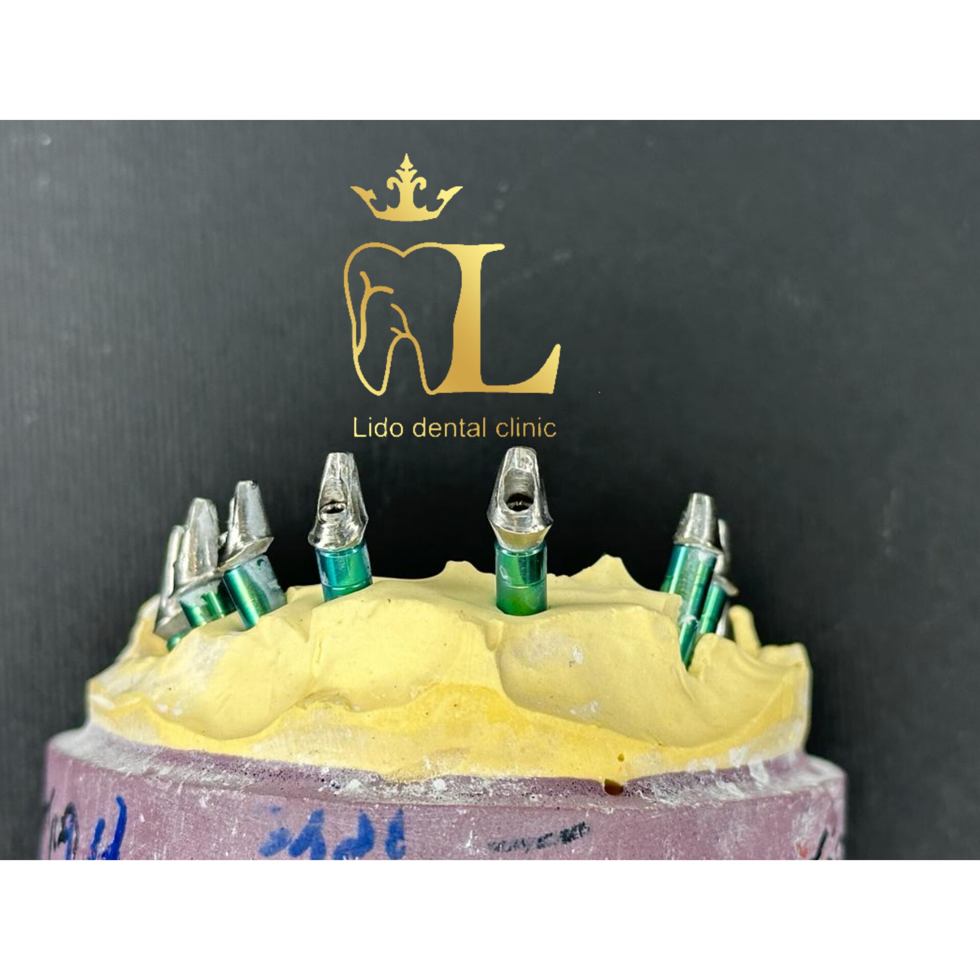 مرکز تخصصی دندانپزشکی لیدو