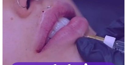 کلینیک لیزر پوست مو زیبایی یاس