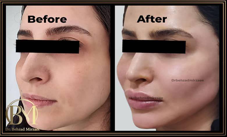 کلینیک زیبایی دکتر بهزاد میرزایی