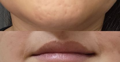 فیشال و پاکسازی مرجان