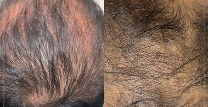 کلینیک پوست مو زیبایی نورا🌙