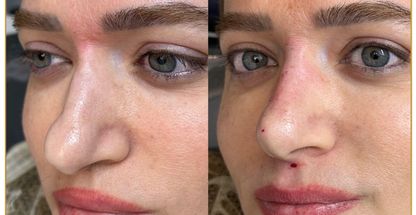 کلینیک زیبایی لی لی