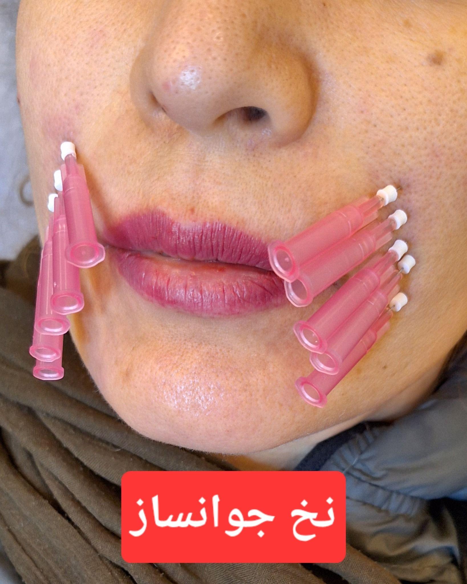 مطب پوست و زیبایی و لیزر بنفشه