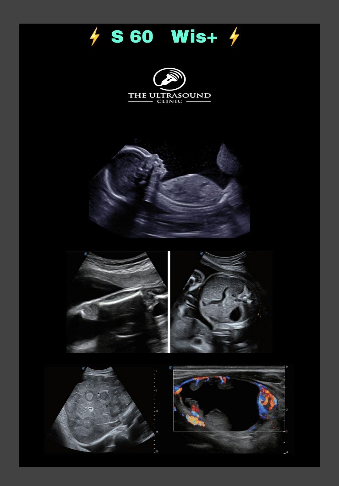 سونوگرافی و رادیولوژی دکتر حسن نیا