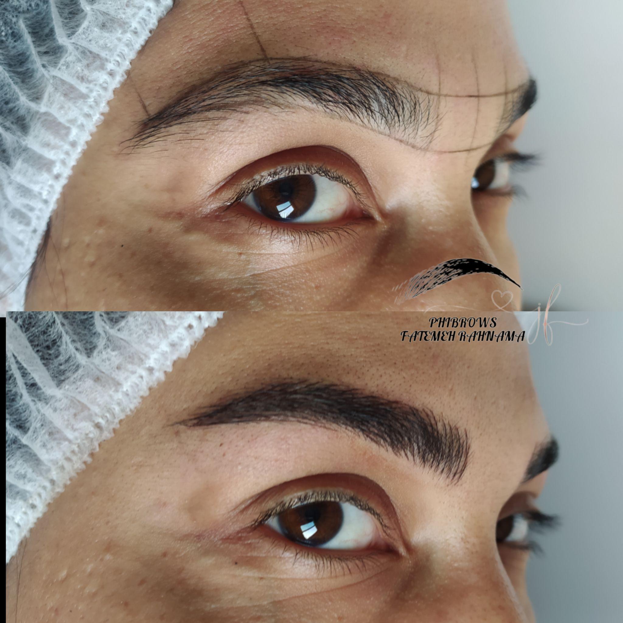 میکروبلیدینگ نچرال رهنما