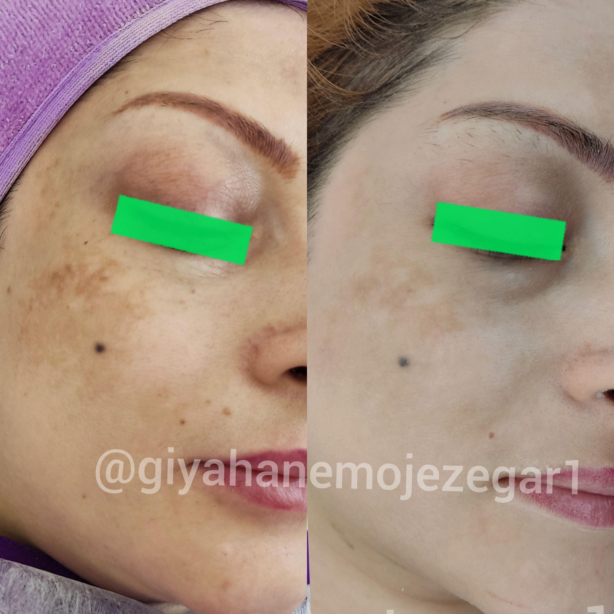 مرکز پوست و مو  معجزه گر