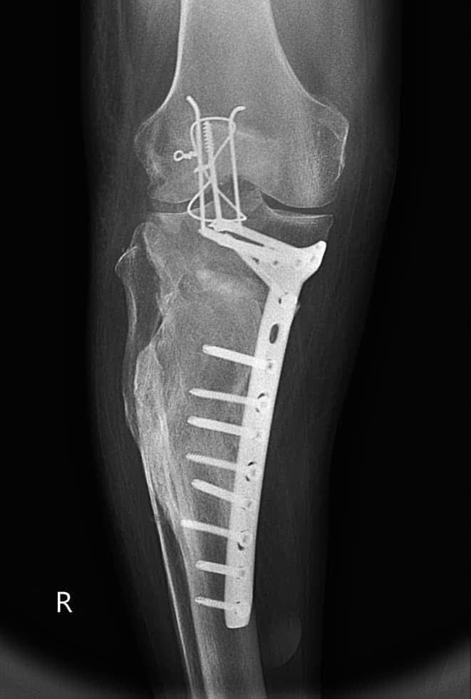 هِلثـــی | خدمات پزشکی و پرستاری در منزل