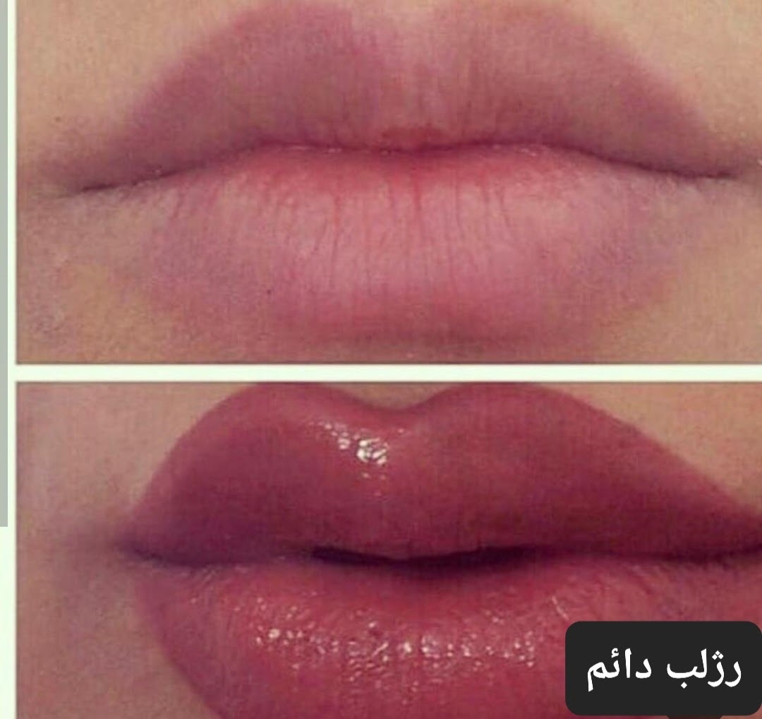 خدمات پوست وزیبایی معصومه ملایی