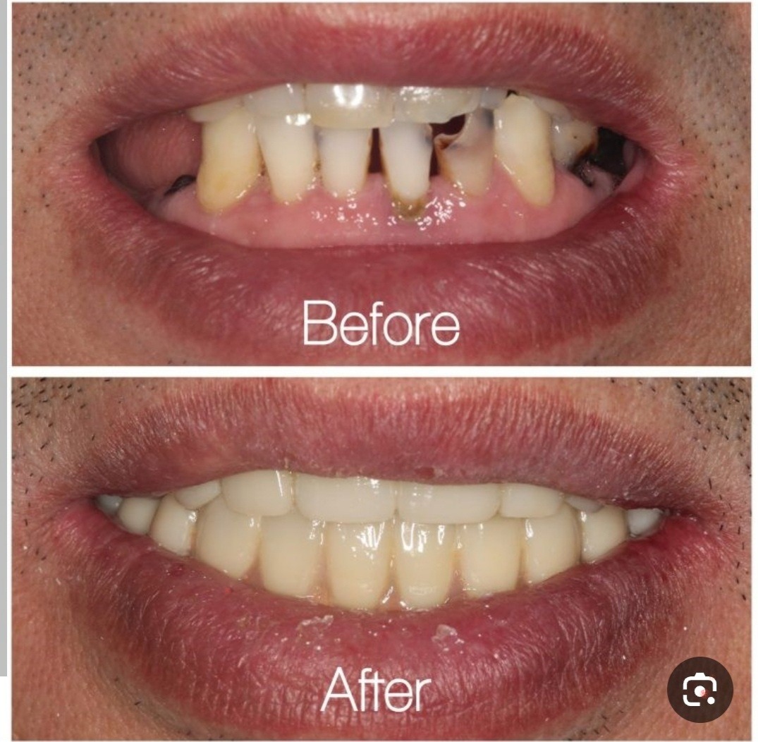 دندانپزشکی تخفیف و خدمت ویژه