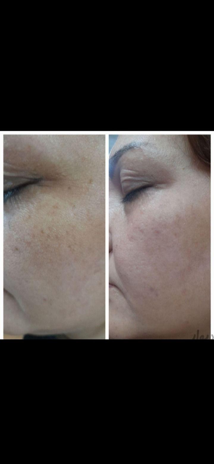 محمدی کراتین