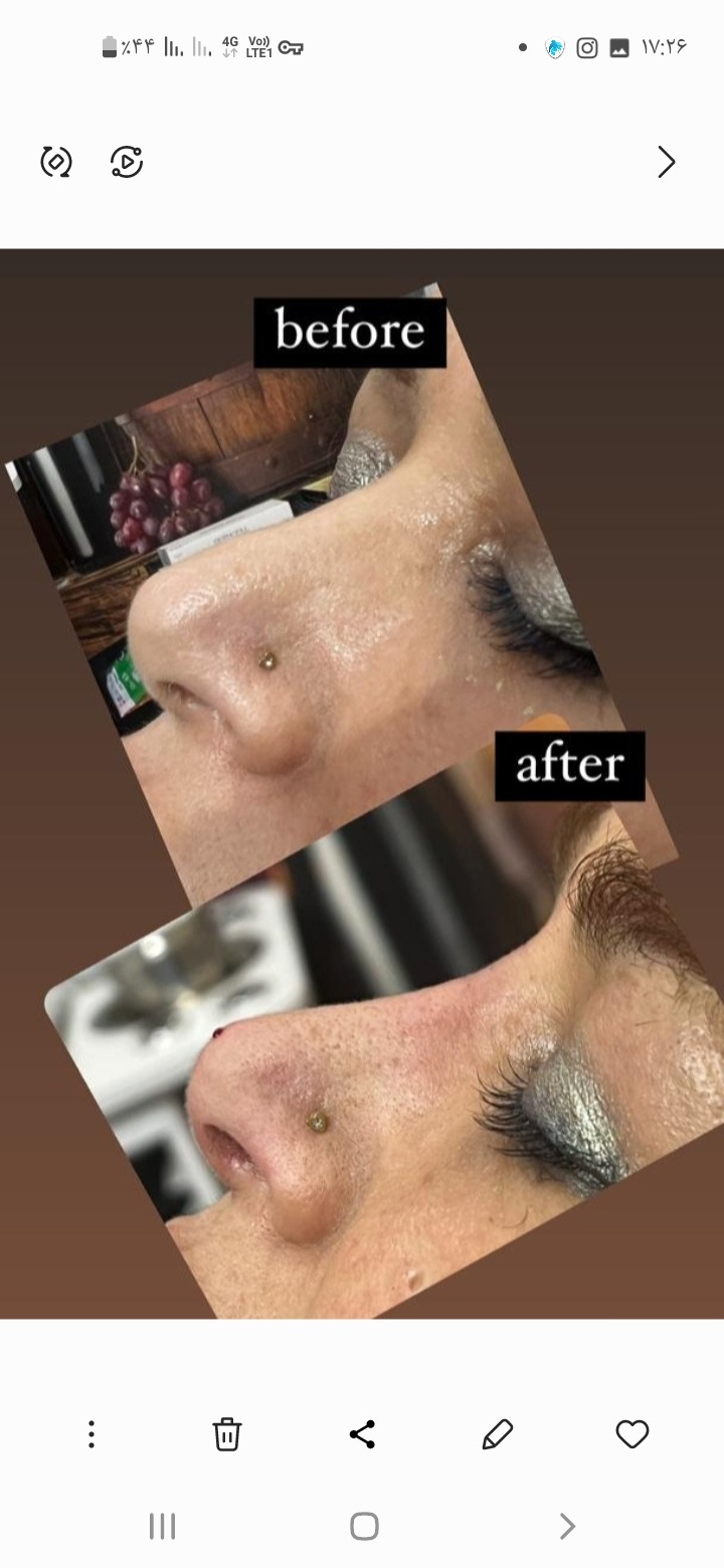 مرکز تزریق ژل و مزو ملکی