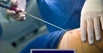 عمل جراحی زیبایی