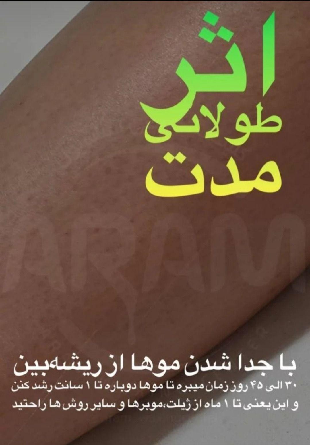 خدمات تخصصی اپیلاسیون اکبری