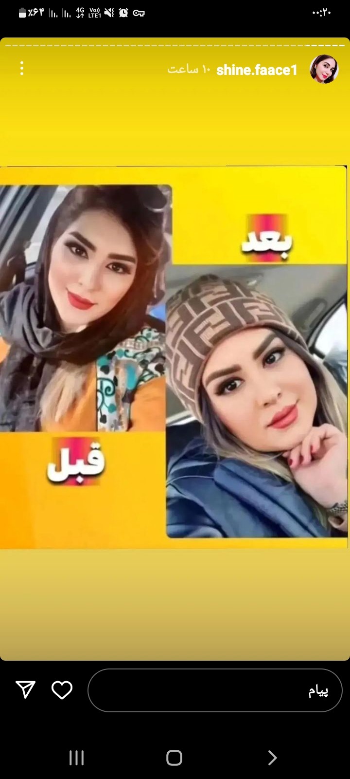 تپلی صورت آرایشی مراقبتی