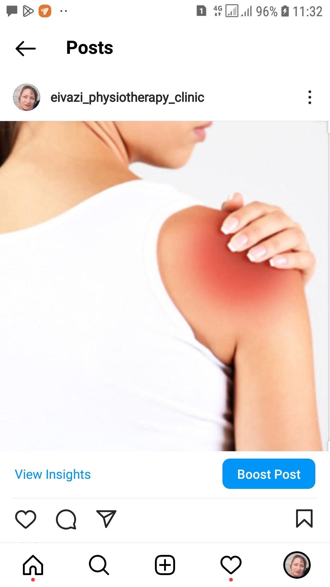 فیزیوتراپی عیوضی