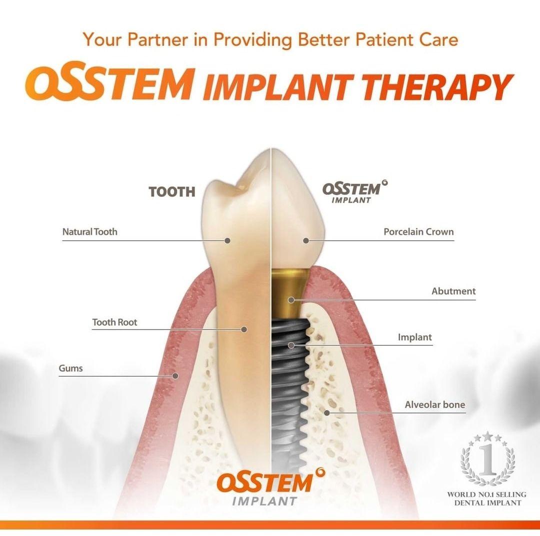 کلینیک دندانپزشکی و ایمپلنت شادی_دکتر محمدرضا ملکی