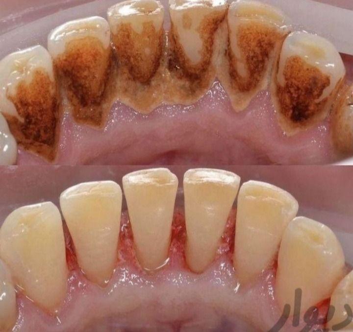 دندانپزشکی و ایمپلنت یونا