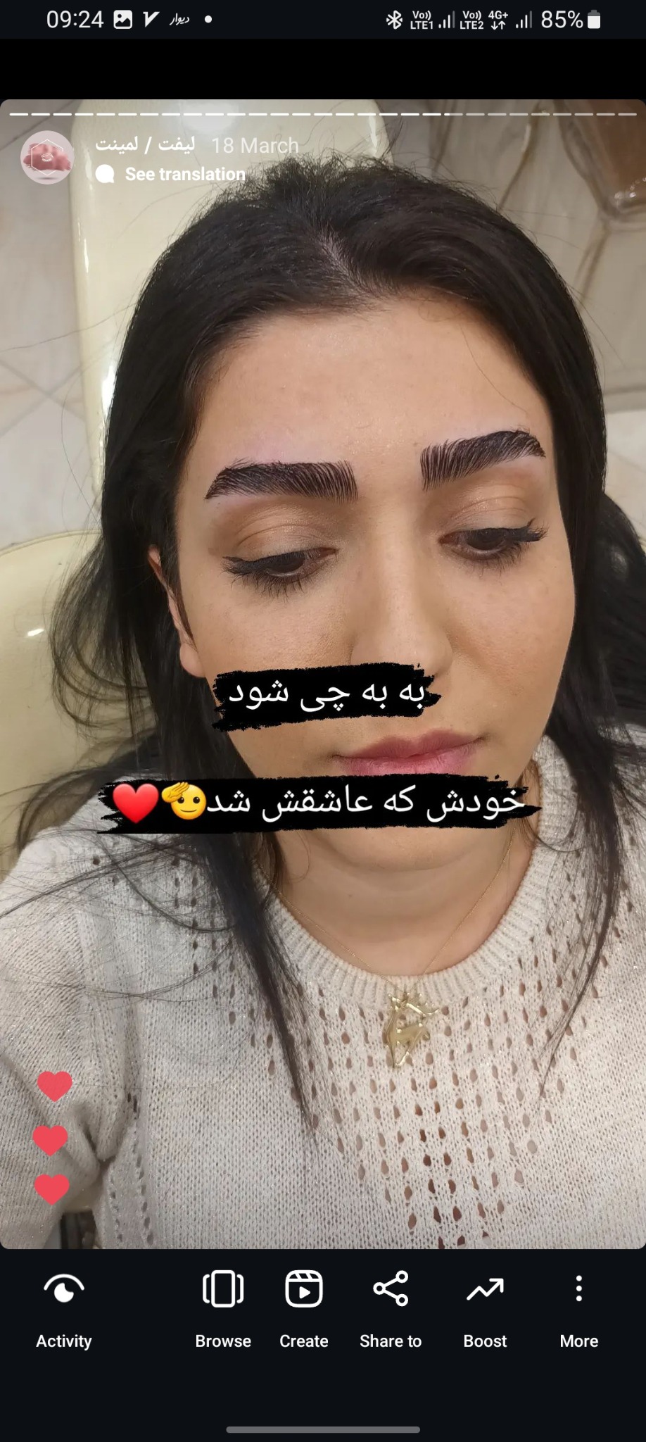 کاشت و اکستیشن