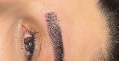 میکروبلیدینگ لیلی اصغری