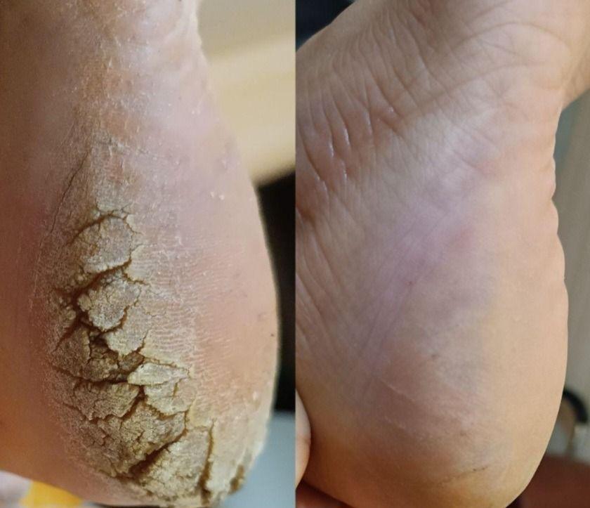 پدیکورکفسابی پاو پارافین تراپی