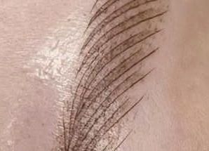 پیگمنتر(تتو صورت، ریموو تخصصی )